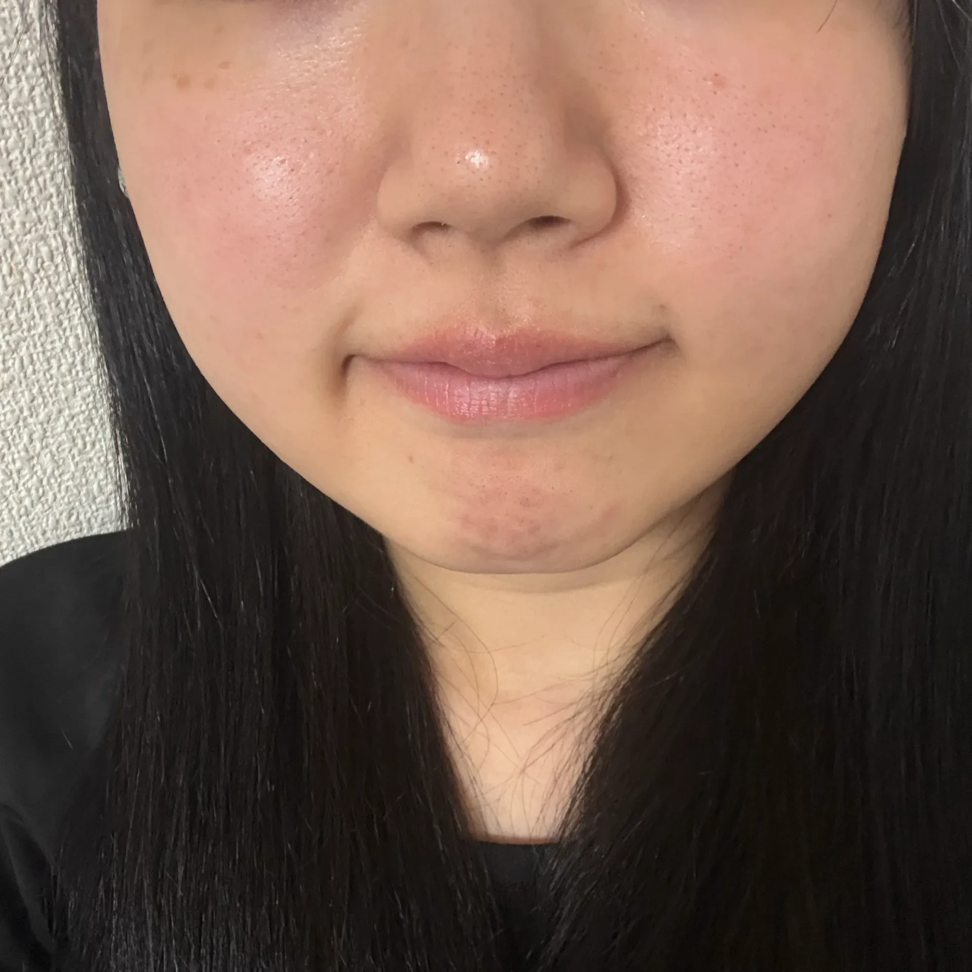 施術の1日後の写真