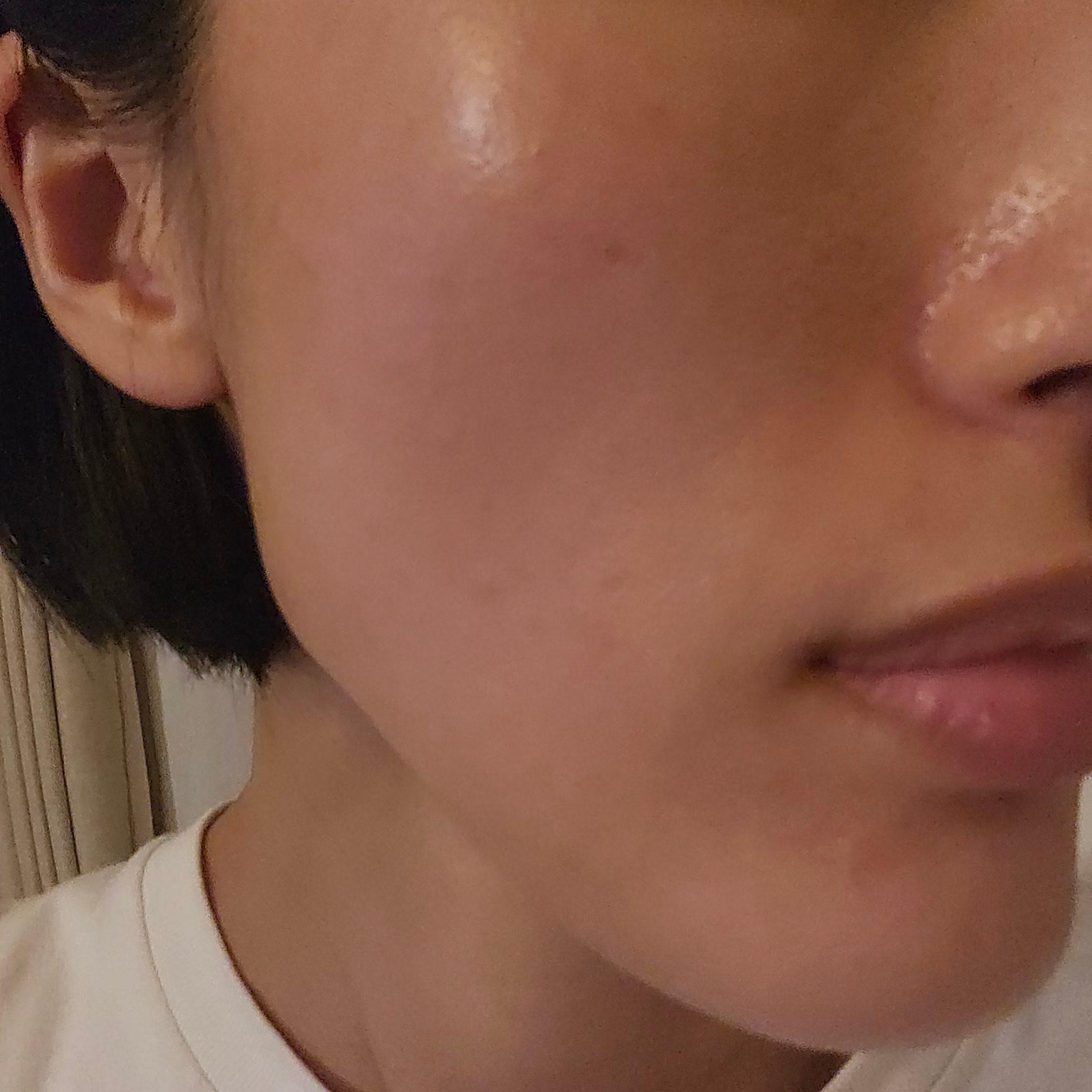 「うるおいあふれる素肌へ💧アクシダーム（エレクトロポレーション」の感想 写真 2