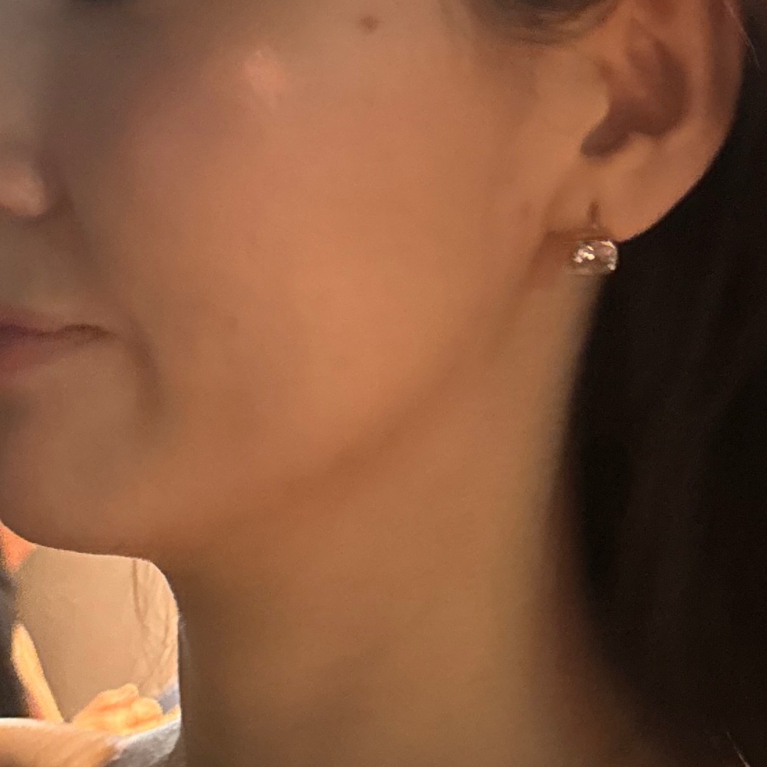 「切らずにリフトアップ💎リフテラV（HIFU）｜あご下〜ほほ」の感想 写真 2