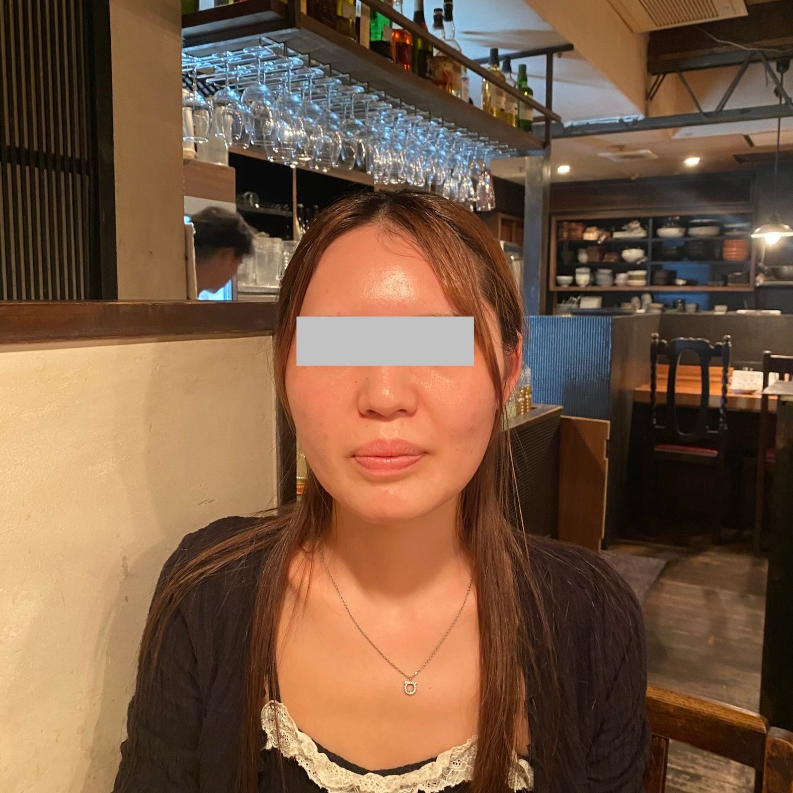 「切らずにリフトアップ💎リフテラV（HIFU）｜あご下〜ほほ」の感想 写真 2